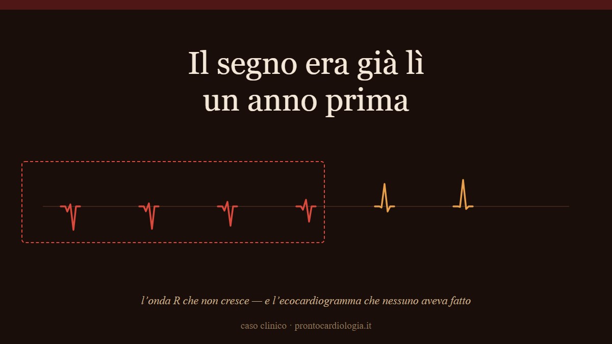 Il segno era già lì un anno prima: perché una visita cardiologica senza ecocardiogramma può non bastare — Prontocardiologia