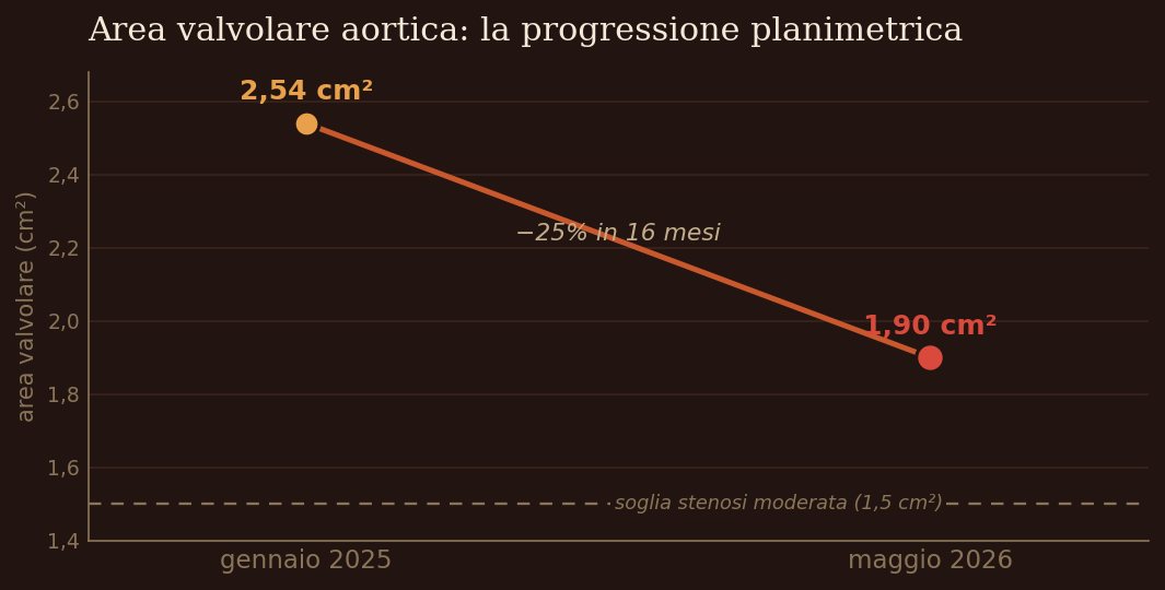 Grafico: l'area della valvola aortica scende da 2,54 a 1,90 cm² tra gennaio 2025 e maggio 2026, una riduzione del 25% in 16 mesi