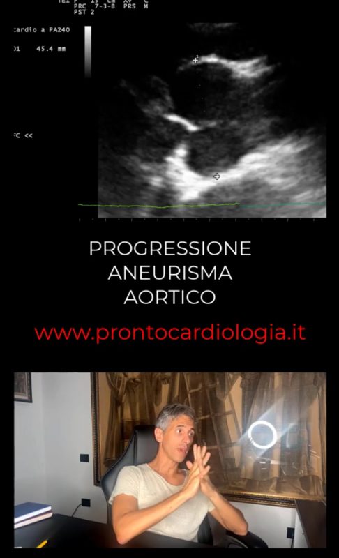 Anteprima caso clinico: PROGRESSIONE ANEURISMA AORTICO